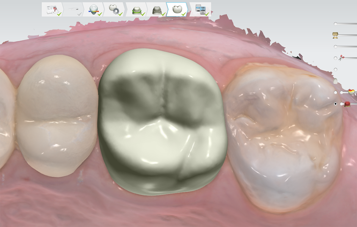 “CU Eradicated My Fear of the Dentist”